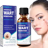WONERBE Liquid Wart Remover, Skin Tag Remover at Home,Fast-Acting Wart Remover Freeze Off, Wart Removal for PlantarWart, GenitalWart, H Warts, CommonWart, FlatWart, Corn, Callus